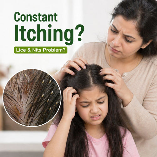 Anti Lice Oil - Advanced Herbal Lice Removal Formula