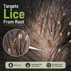 Anti Lice Oil - Advanced Herbal Lice Removal Formula