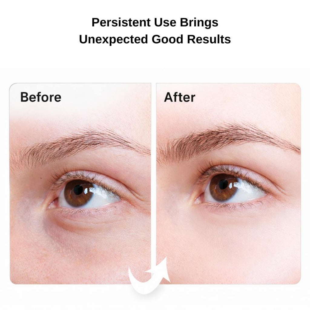SheGlow 24K Gold Glow Under Eye Patches