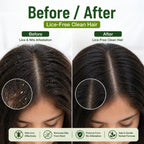 Anti Lice Oil - Advanced Herbal Lice Removal Formula